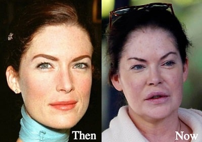 A picture of Lara Flynn Boyle in the past (left) and present (right).
